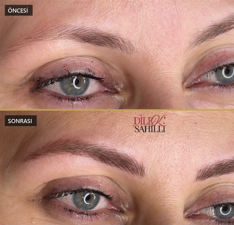 Microblading kaş tasarımı öncesi ve sonrası